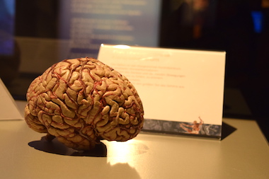 Körperwelten (Fotos: Kleine-besten/STUGGI.TV)